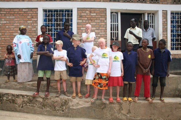 Burundi – Fondation Stamm bietet Albino-Kindern einen Weg in eine sichere Zukunft